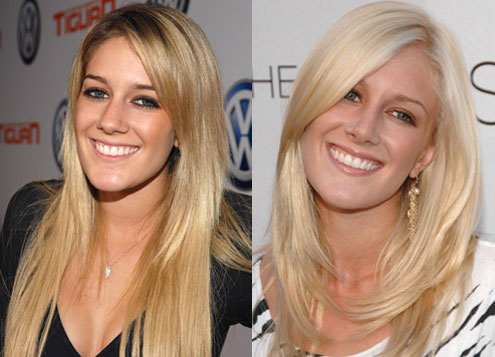 heidi montag after surgery. heidi montag is an idiot.